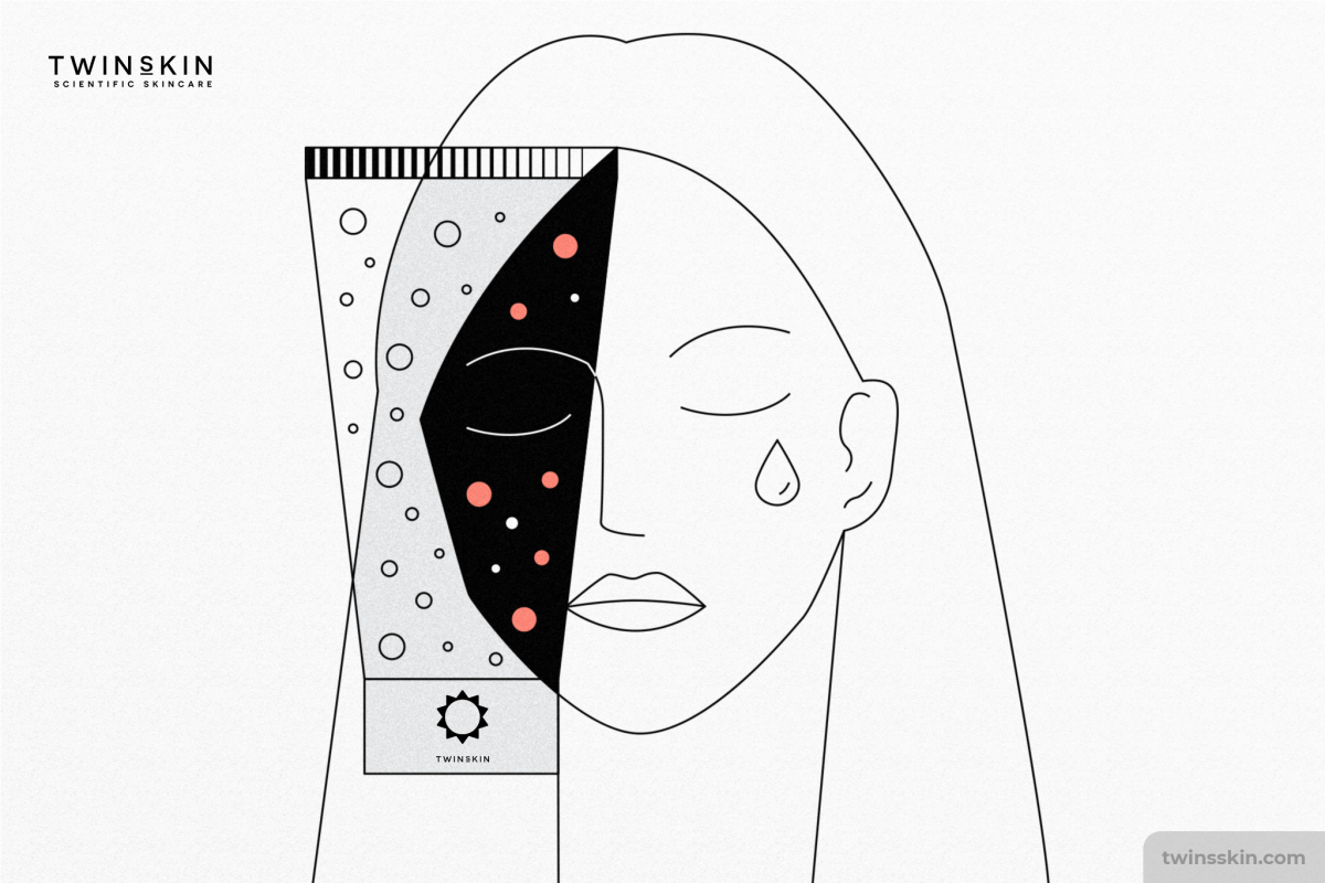 kích ứng dị ứng kem chống nắng