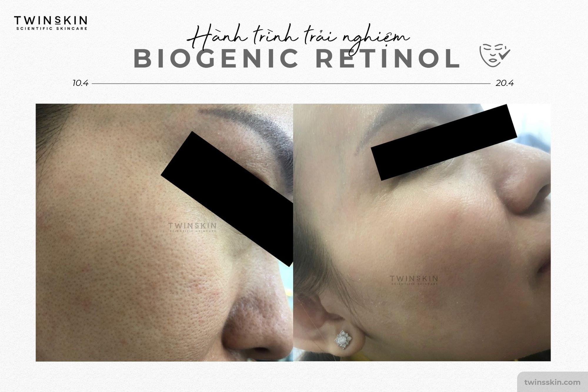 BIOGENIC RETINOL 1% FOR ADVANCE TRAVEL SIZE - Kem Dưỡng Da, Ngừa Lão Hoá, Giảm Mụn - Ảnh 4