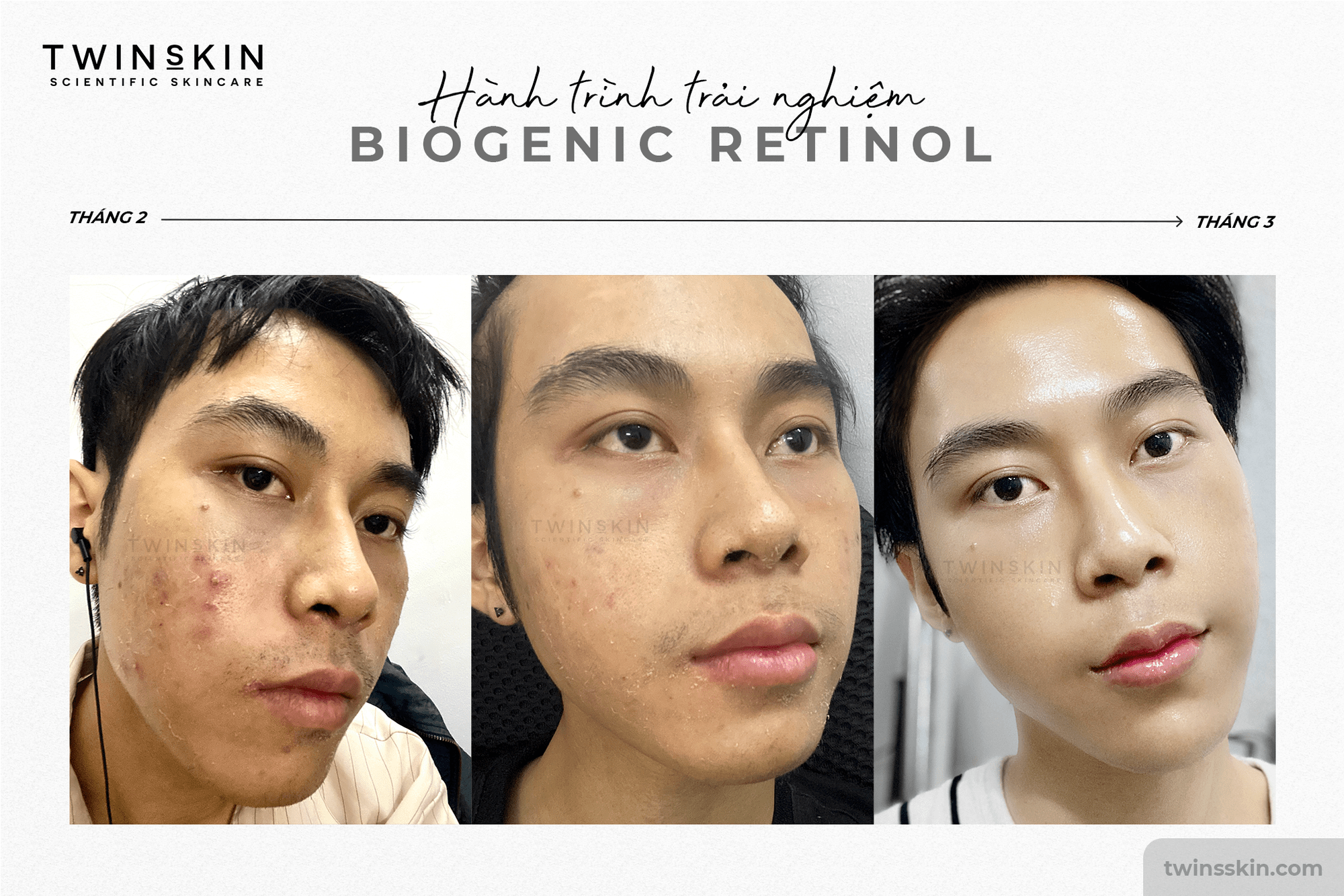 BIOGENIC RETINOL 1% FOR ADVANCE TRAVEL SIZE - Kem Dưỡng Da, Ngừa Lão Hoá, Giảm Mụn - Ảnh 5