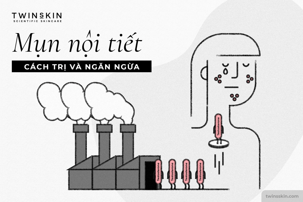 cách trị mụn nội tiết