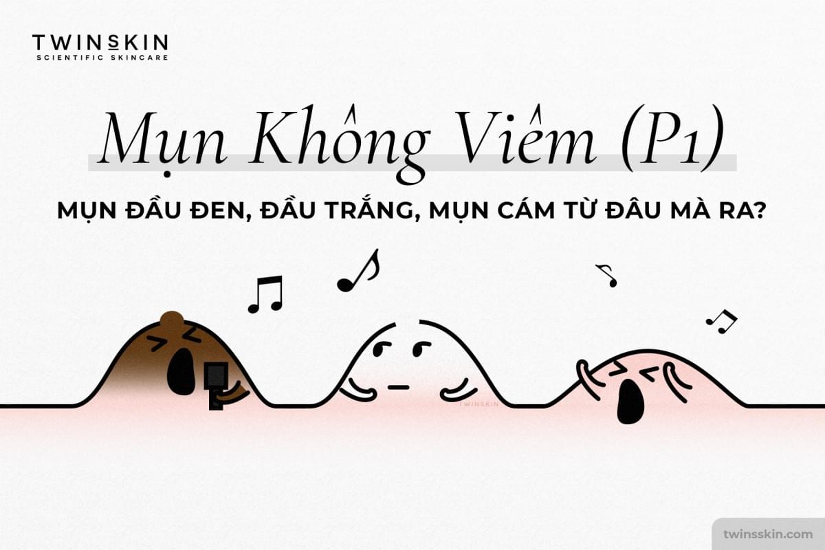 mụn không viêm