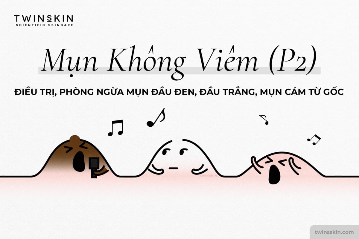 mụn không viêm
