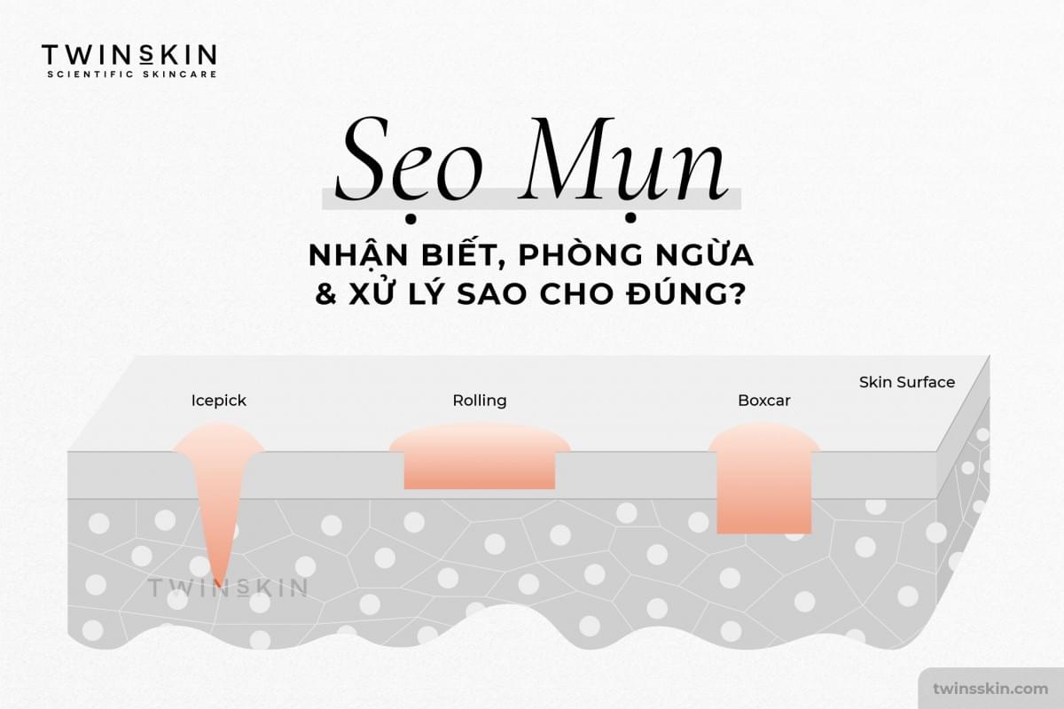 sẹo mụn twins skin