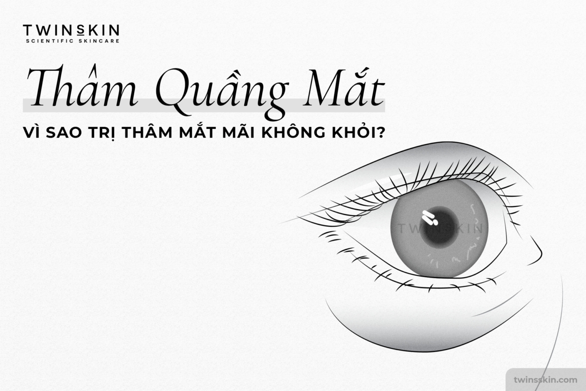 trị quầng thâm mắt