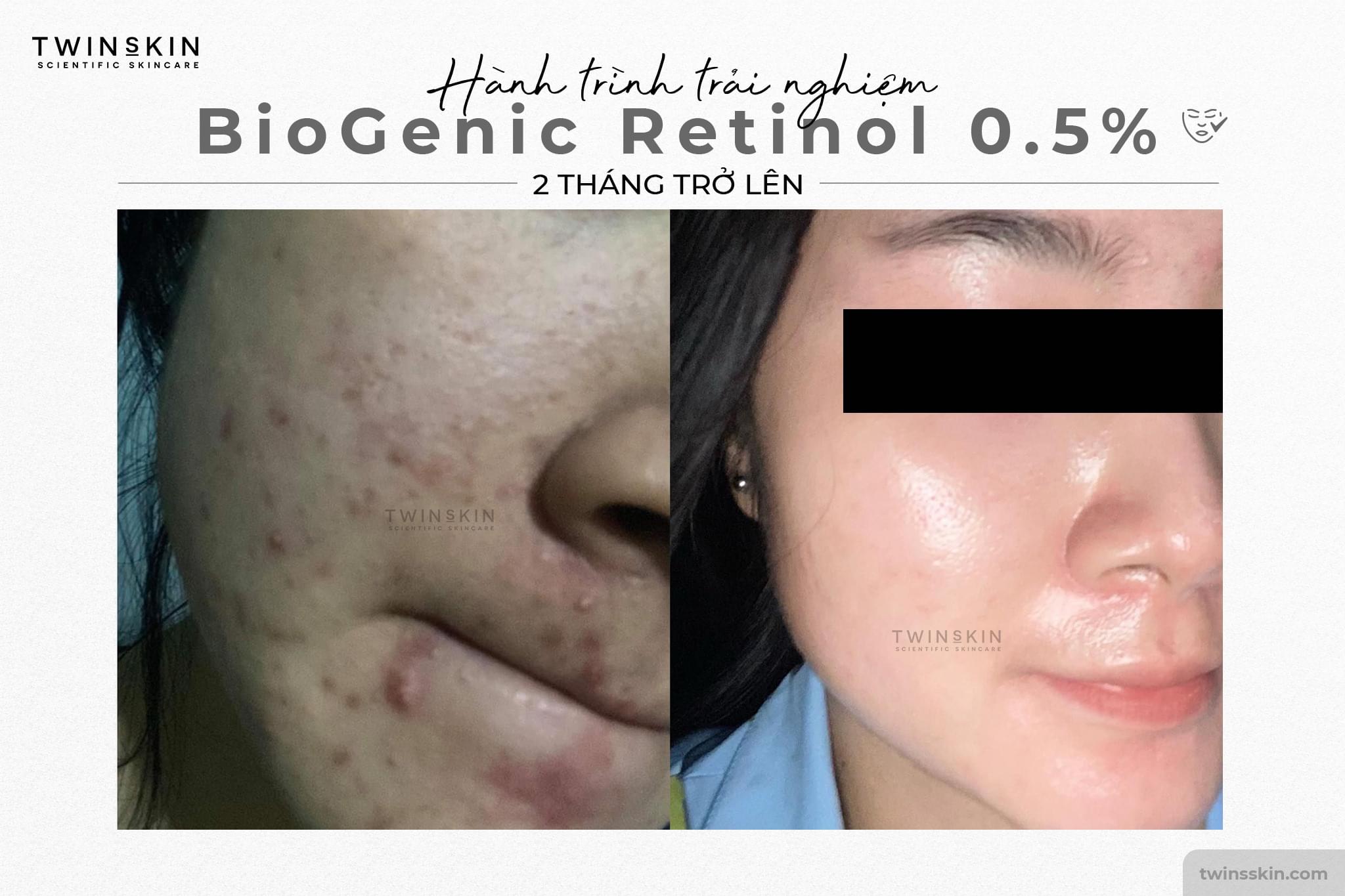 BIOGENIC RETINOL 0.5% FOR BEGINNER FULL SIZE – Kem Dưỡng Da, Giảm Mụn, Ngừa Lão Hoá - Twins Skin