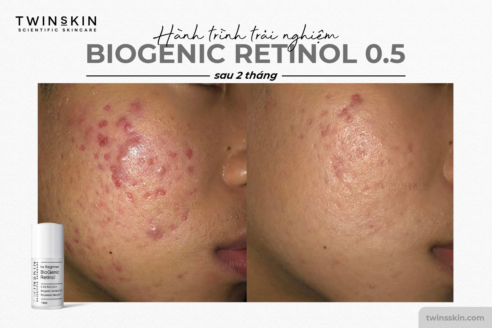 BIOGENIC RETINOL 0.5% FOR BEGINNER FULL SIZE – Kem Dưỡng Da, Giảm Mụn, Ngừa Lão Hoá - Twins Skin