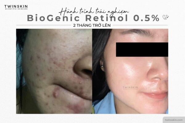 feedback-retinol-tri-mun