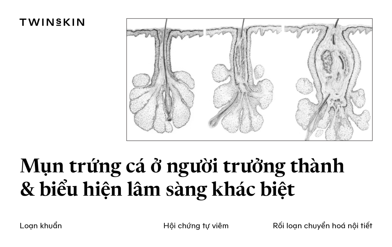 cover-mun-o-tuoi-truong-thanh
