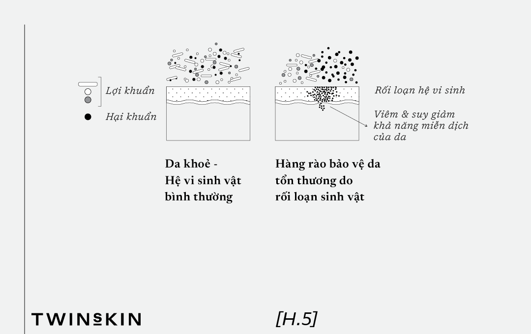 viem-sau-xam-lan-da-1