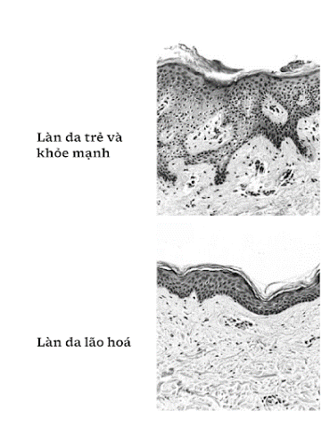 Cấu trúc khác nhau giữa một làn da trẻ và khỏe mạnh so với một làn da lão hóa.