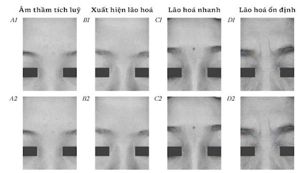 Biểu hiện của 4 giai đoạn lão hóa ở da phụ nữ Trung Quốc.