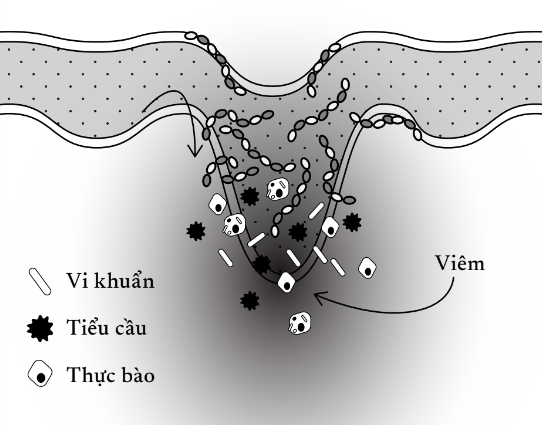 HA hoạt động như một chất điều chỉnh tình trạng viêm