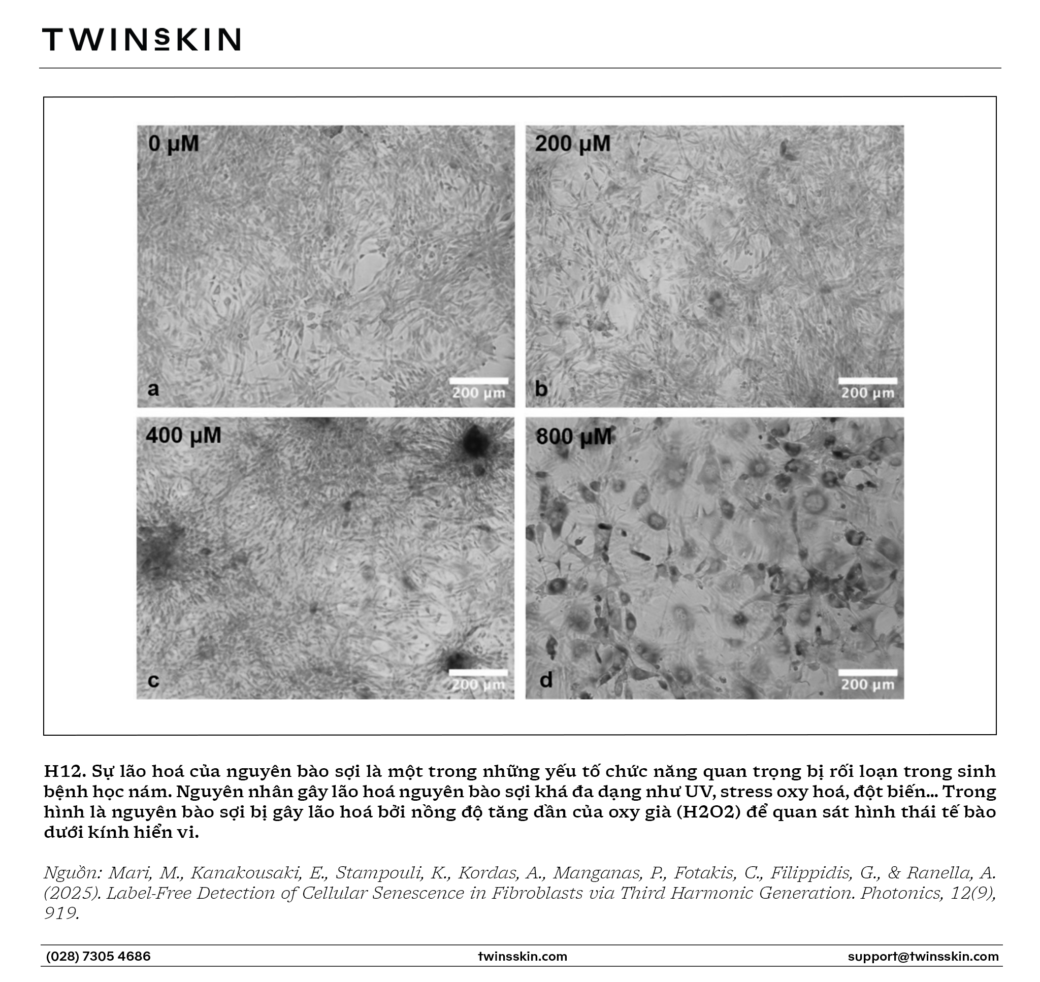 Hệ thống enzyme k&iacute;ch th&iacute;ch sinh n&aacute;m