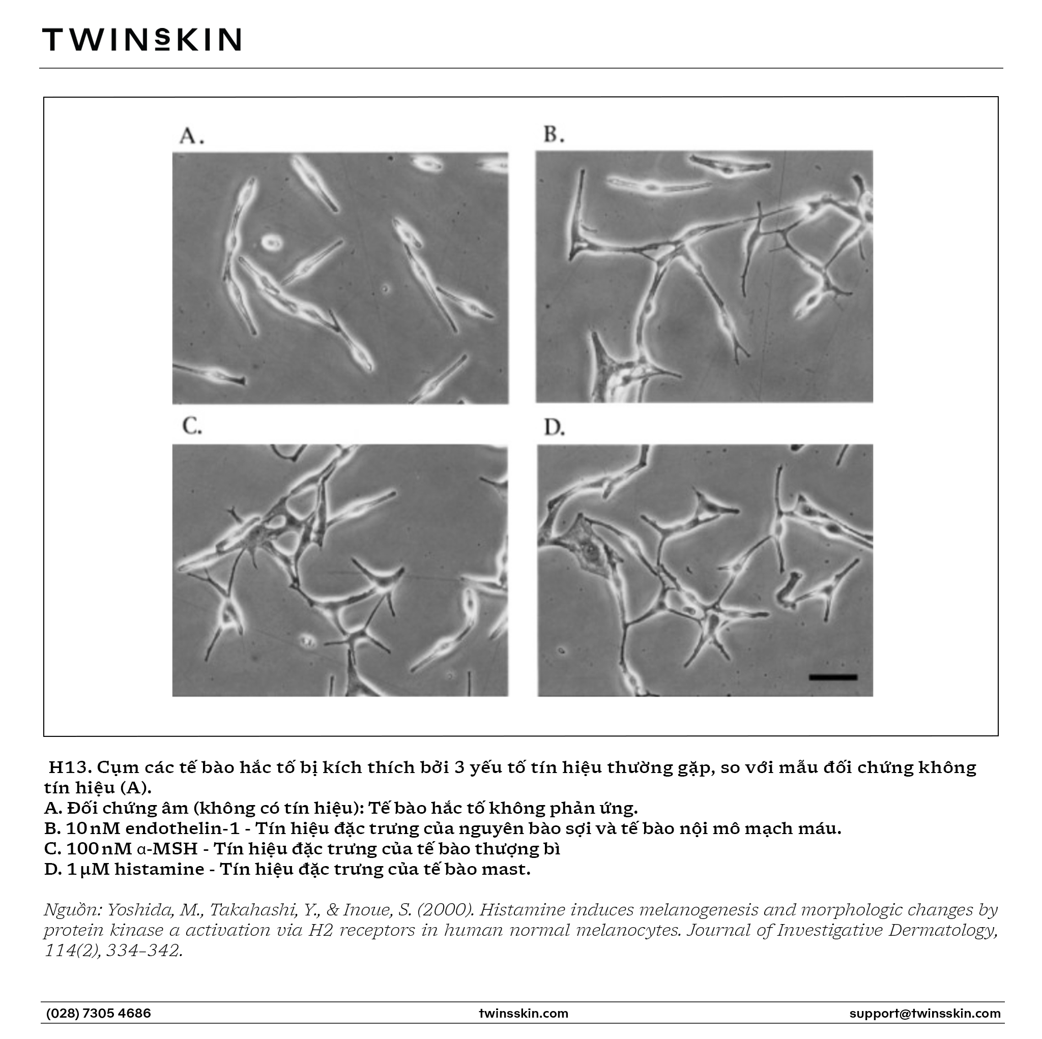 Hệ thống enzyme kích thích sinh nám