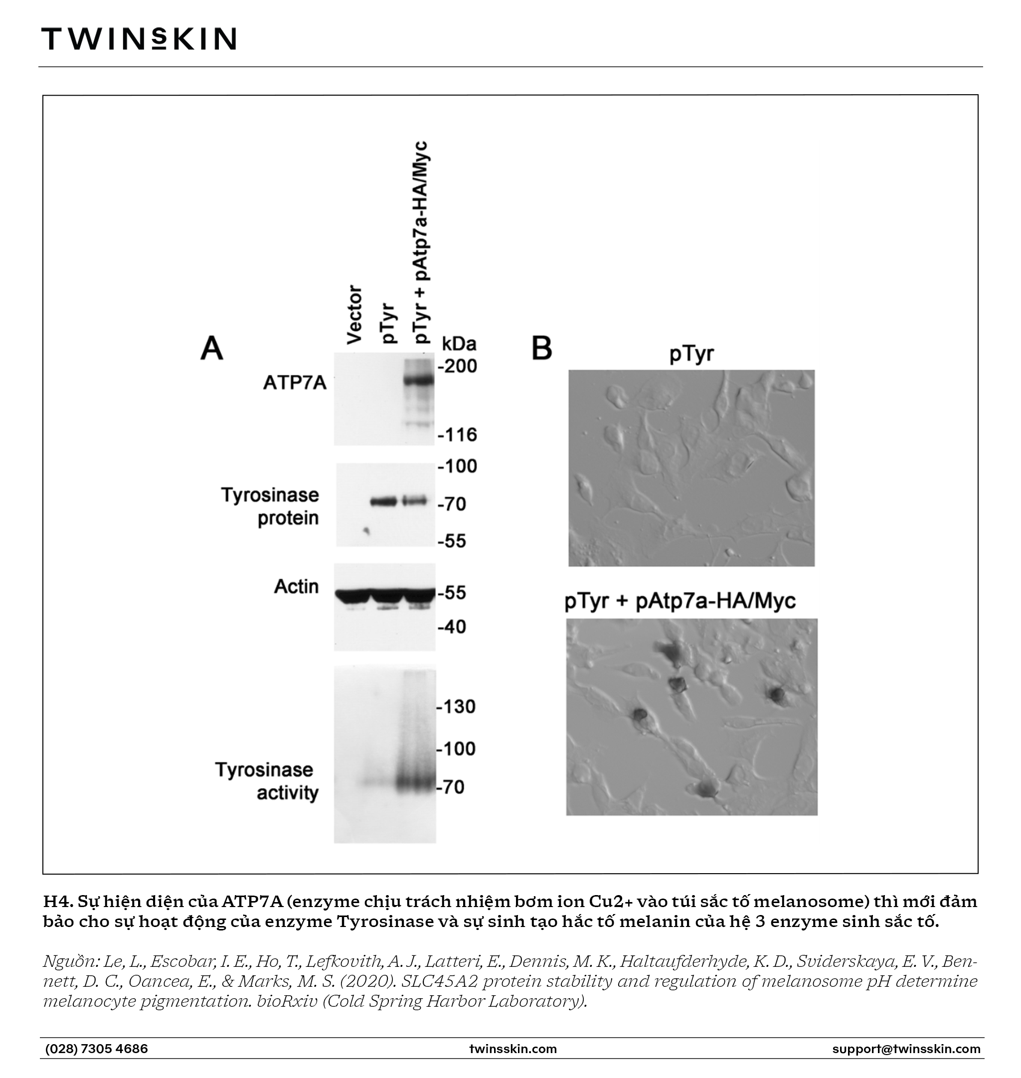 Hệ thống enzyme kích thích sinh nám