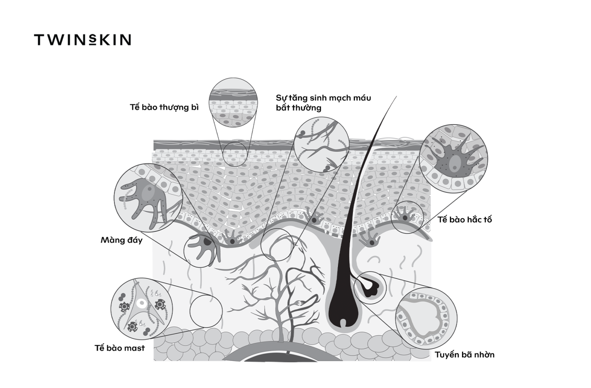 Hệ thống tế bào lân cận kích thích tế bào hắc tố sinh nám