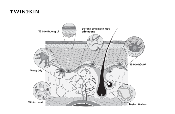 Hệ thống tế bào lân cận kích thích tế bào hắc tố sinh nám